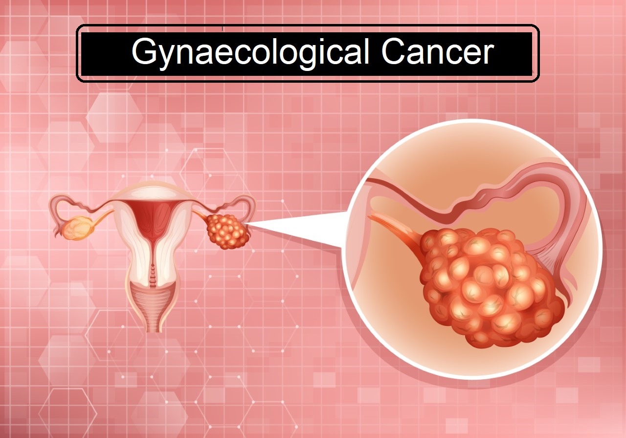 Gynaecological Cancer